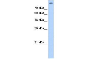 ALOX15B antibody used at 2. (ALOX15B anticorps  (C-Term))