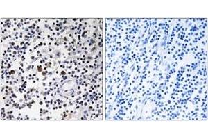 Immunohistochemistry analysis of paraffin-embedded human lymph node tissue, using CD302 Antibody.