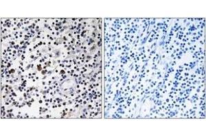 Immunohistochemistry analysis of paraffin-embedded human lymph node tissue, using CD302 Antibody. (DCL1 anticorps  (AA 51-100))