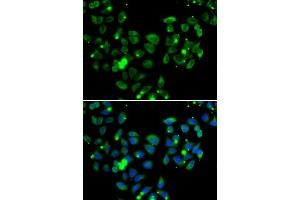 Immunofluorescence analysis of A549 cells using CARD11 antibody (ABIN5974295). (CARD11 anticorps)