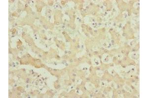 Immunohistochemistry of paraffin-embedded human liver tissue using ABIN7174957 at dilution of 1:100 (MYO5B anticorps  (AA 1440-1690))
