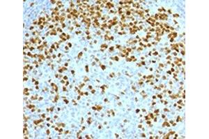 IHC testing of FFPE human tonsil with Topoisomerase II alpha antibody (clone TPM2A-2). (Topoisomerase II alpha anticorps)