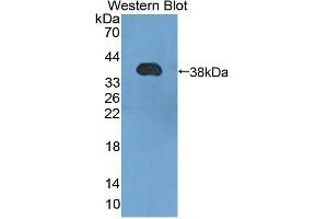 Western blot analysis of the recombinant protein. (HSF4 anticorps  (AA 91-407))
