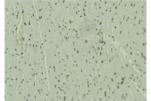 ABIN6277652 at 1/100 staining Mouse muscle tissue by IHC-P. (WHSC1L1 anticorps  (N-Term))