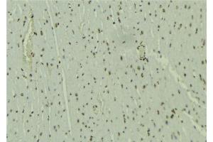 anti-Wolf-Hirschhorn Syndrome Candidate 1-Like 1 (WHSC1L1) (N-Term) antibody