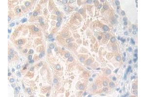 Detection of KLK11 in Human Kidney Tissue using Polyclonal Antibody to Kallikrein 11 (KLK11)