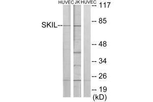 Western blot analysis of extracts from HUVEC cells and Jurkat cells, using SKIL antibody.
