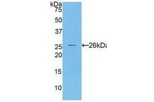 Western blot analysis of recombinant Human CTSS. (Cathepsin S anticorps  (AA 115-331))