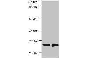 Western blot All lanes: C7orf50 antibody at 2 μg/mL Lane 1: A549 whole cell lysate Lane 2: MCF-7 whole cell lysate Secondary Goat polyclonal to rabbit IgG at 1/10000 dilution Predicted band size: 23 kDa Observed band size: 23 kDa (SAMD9 anticorps  (AA 1-194))