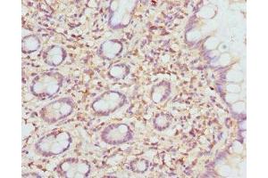 Immunohistochemistry of paraffin-embedded human small intestine tissue using ABIN7151501 at dilution of 1:100