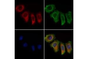 ABIN7094741 and ABIN7098792 staining Hela cells by IF/ICC. (DBT anticorps  (C-Term))