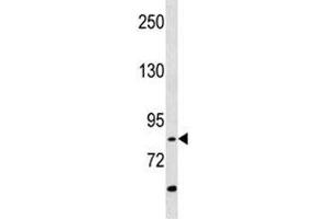 RIPK4 antibody western blot analysis in A549 lysate