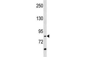 RIPK4 antibody western blot analysis in A549 lysate (RIPK4 anticorps  (AA 802-832))
