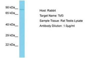 Image no. 1 for anti-Transcription Factor 3 (E2A Immunoglobulin Enhancer Binding Factors E12/E47) (TCF3) (AA 551-600) antibody (ABIN6750234) (TCF3 anticorps  (AA 551-600))