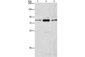 Western Blot analysis of Human brain malignant glioma tissue, A172 and 293T cell using ARHGEF7 Polyclonal Antibody at dilution of 1:800 (ARHGEF7 anticorps)