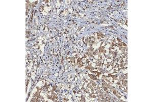 IHC analysis of mSin3A/SIN3A using anti-mSin3A/SIN3A antibody (ABIN7602504). (SIN3A anticorps  (AA 8-918))