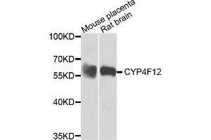 Western blot analysis of extracts of various cell lines, using CYP4F12 antibody (ABIN5974476) at 1/1000 dilution. (CYP4F12 anticorps)