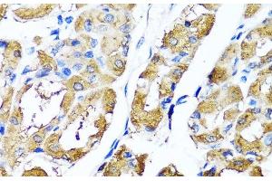 Immunohistochemistry of paraffin-embedded Human stomach using HYAL1 Polyclonal Antibody at dilution of 1:100 (40x lens).