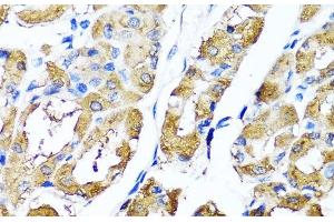 Immunohistochemistry of paraffin-embedded Human stomach using HYAL1 Polyclonal Antibody at dilution of 1:100 (40x lens). (HYAL1 anticorps)