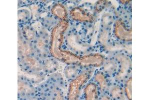Used in DAB staining on fromalin fixed paraffin- embedded kidney tissue