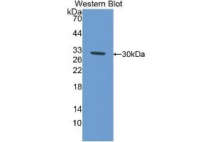 Western Blotting (WB) image for anti-Interleukin 17 Receptor D (IL17RD) (AA 356-603) antibody (ABIN1859364)