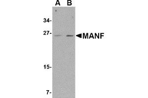 Western Blotting (WB) image for anti-Mesencephalic Astrocyte-Derived Neurotrophic Factor (MANF) (C-Term) antibody (ABIN1030505) (MANF anticorps  (C-Term))