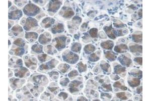 Detection of CBR1 in Mouse Stomach Tissue using Polyclonal Antibody to Carbonyl Reductase 1 (CBR1)