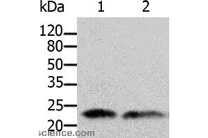 Western blot analysis of Human fetal brain and kidney tissue, using ARF1 Polyclonal Antibody at dilution of 1:500 (ARF1 anticorps)