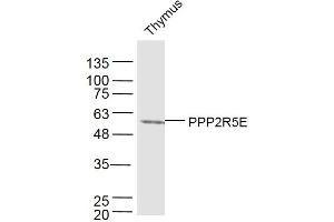 Mouse thymus lysates probed with PPP2R5E Polyclonal Antibody, Unconjugated  at 1:300 dilution and 4˚C overnight incubation.
