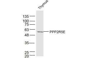 Mouse thymus lysates probed with PPP2R5E Polyclonal Antibody, Unconjugated  at 1:300 dilution and 4˚C overnight incubation. (PPP2R5E anticorps  (AA 121-220))