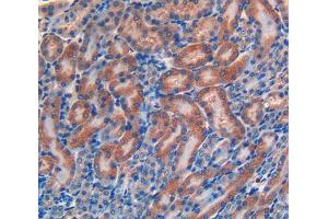 IHC-P analysis of kidney tissue, with DAB staining. (LIFR anticorps  (AA 641-790))