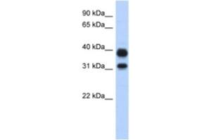 Western Blotting (WB) image for anti-Chitinase, Acidic (CHIA) antibody (ABIN2463911) (CHIA anticorps)
