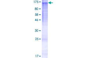Image no. 1 for Hermansky-Pudlak Syndrome 5 (HPS5) (AA 1-1015) protein (GST tag) (ABIN1307046)
