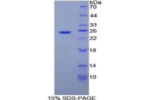SDS-PAGE analysis of Human ADH1 Protein. (ADH1 Protéine)