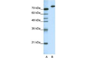 WB Suggested Anti-KLHL3 Antibody Titration:  1. (KLHL3 anticorps  (N-Term))