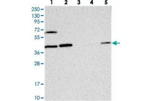 Western blot analysis of Lane 1: RT-4, Lane 2: U-251 MG, Lane 3: Human Plasma, Lane 4: Liver, Lane 5: Tonsil with COPS4 polyclonal antibody  at 1:250-1:500 dilution. (COPS4 anticorps)