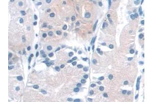 DAB staining on IHC-P; Samples: Human Stomach Tissue (NADK anticorps  (AA 187-426))
