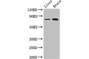 Western Blot Positive WB detected in: Mouse liver tissue, Mouse brain tissue All lanes: TBK1 antibody at 3 μg/mL Secondary Goat polyclonal to rabbit IgG at 1/50000 dilution Predicted band size: 84 kDa Observed band size: 84 kDa (TBK1 anticorps  (AA 364-585))