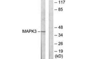 Western blot analysis of extracts from COLO205 cells, using MAPK3 Antibody. (ERK1 anticorps  (AA 301-350))