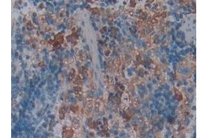 Detection of FCN1 in Rat Spleen Tissue using Polyclonal Antibody to Ficolin 1 (FCN1)