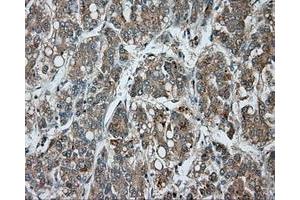 Image no. 4 for anti-Bruton Agammaglobulinemia tyrosine Kinase (BTK) antibody (ABIN1496976) (BTK anticorps)