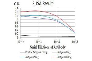 Black line: Control Antigen (100 ng),Purple line: Antigen (10 ng), Blue line: Antigen (50 ng), Red line:Antigen (100 ng)
