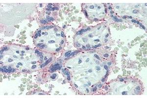 anti-Interleukin 6 Receptor (IL6R) (AA 216-356) antibody