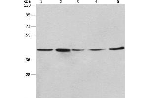 Western Blot analysis of A549, NIH/3T3 and 293T cell,Human hepatocellular carcinoma tissue and hela cell using RPSA Polyclonal Antibody at dilution of 1:425 (RPSA/Laminin Receptor anticorps)