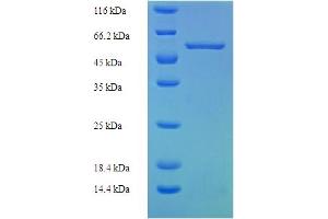 SDS-PAGE (SDS) image for Family with Sequence Similarity 49, Member B (FAM49B) (AA 1-324), (full length) protein (His-SUMO Tag) (ABIN5711839)