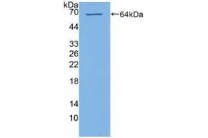 Detection of Recombinant PI4Ka, Human using Polyclonal Antibody to Phosphatidylinositol-4-Kinase Catalytic Alpha (PI4Ka) (PI4KA anticorps  (AA 1-300))