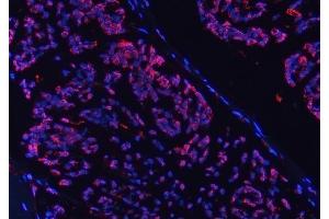 IF analysis of COX5B using anti-COX5B antibody (ABIN7598975).