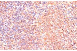Immunohistochemistry of paraffin-embedded Rat spleen using IL4R Polyclonal Antibody at dilution of 1:100 (40x lens).