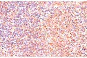 Immunohistochemistry of paraffin-embedded Rat spleen using IL4R Polyclonal Antibody at dilution of 1:100 (40x lens). (IL4 Receptor anticorps)