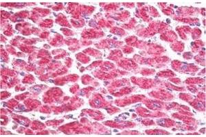 Formalin-Fixed, Paraffin-Embedded Human Heart stained with MSK1